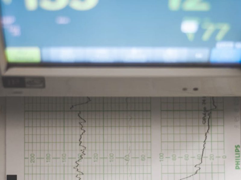 IA et santé connectée : révolution médicale ou mirage tech ?