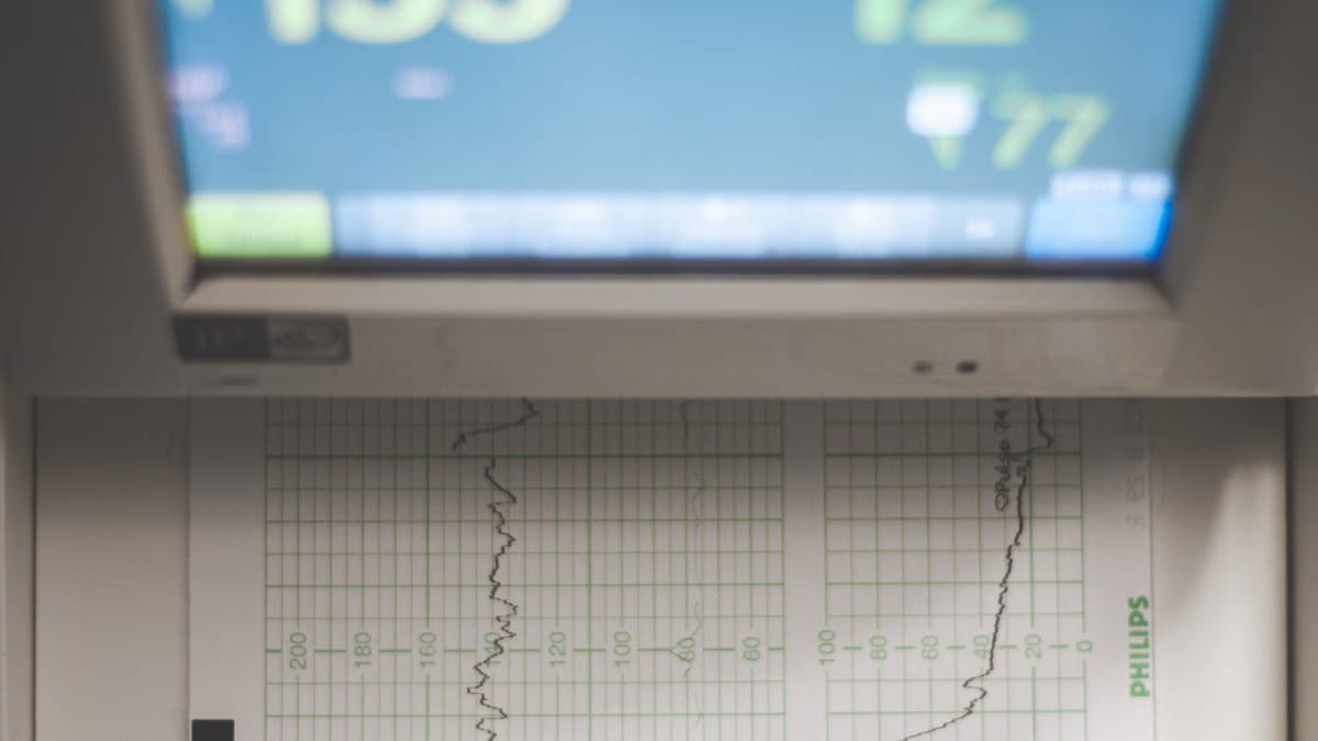 IA et santé connectée : révolution médicale ou mirage tech ?